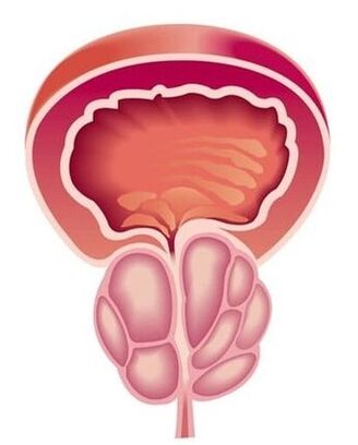 Symptômes de la prostatite chez les hommes