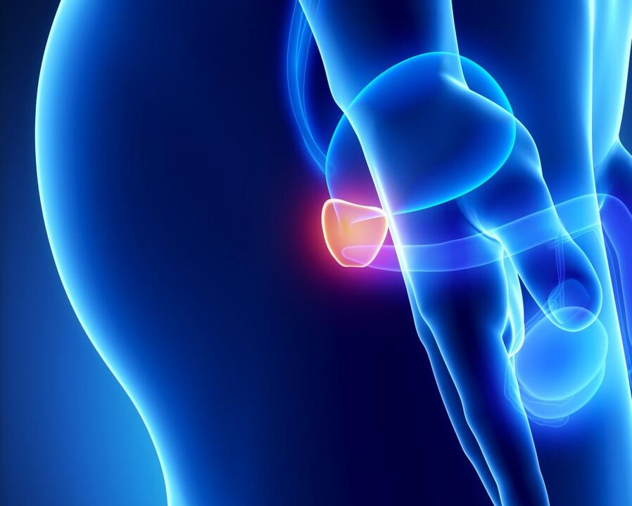 Inflammation de la prostate