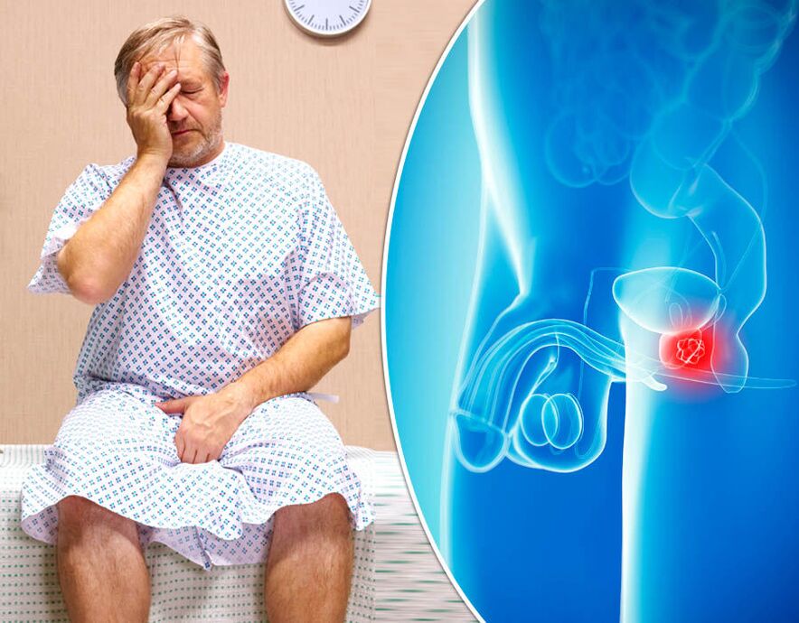 Un homme atteint de prostatite subit un diagnostic de la maladie